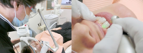 歯科用レーザー治療の様子